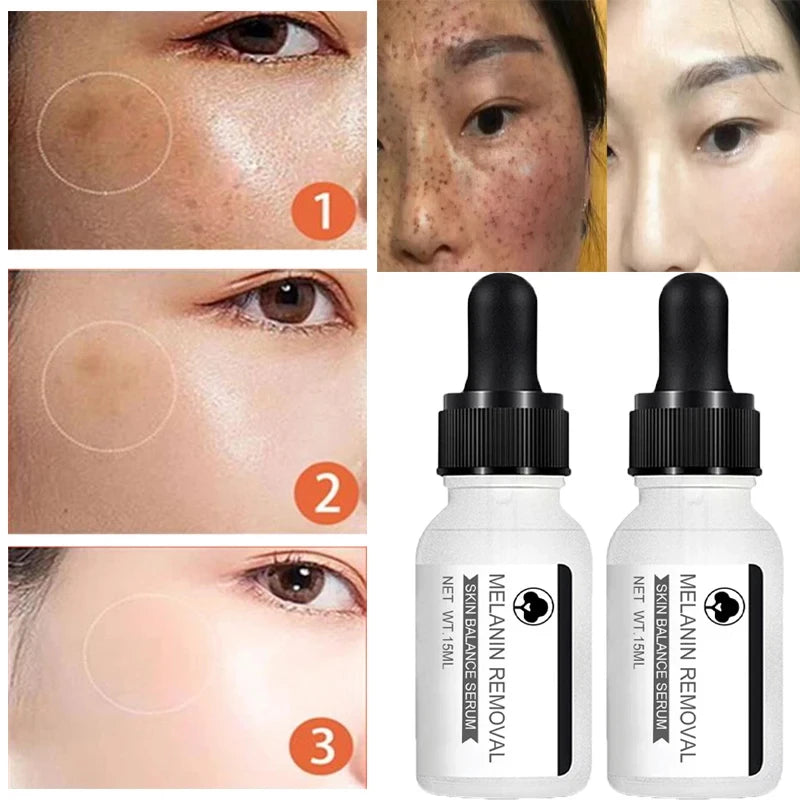 Saashi Niacinamide Dark Spot Serum for Skin